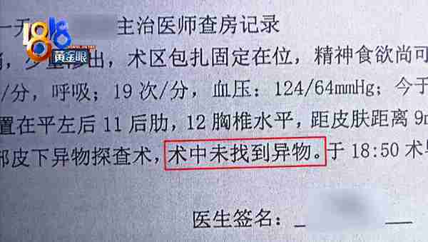 吸脂术探头留在姑娘体内,院方两次手术都没取出
