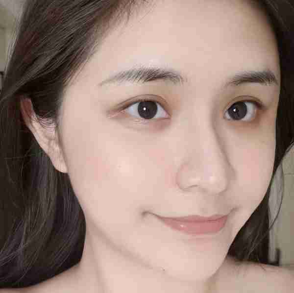 姑娘来太原丽都医院隆鼻整形,术后半年“惊艳”所有人!