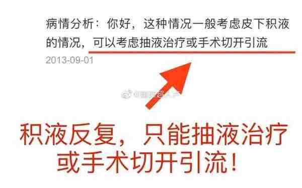 吸脂术后有积液是啥原因?
