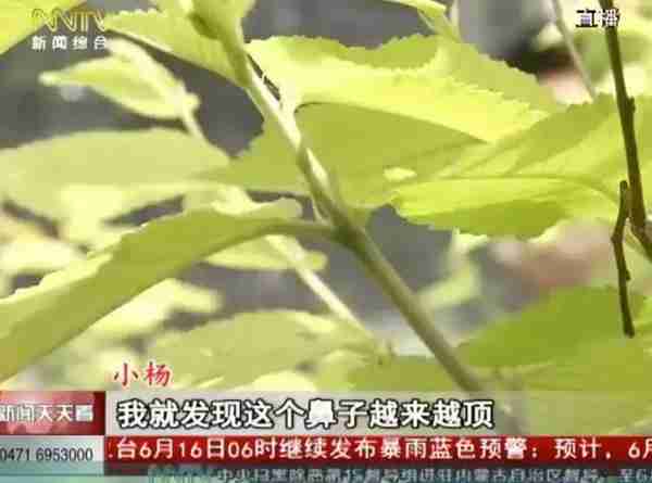 「天天看•热线」术后特别疼!19岁学生花7千多隆鼻,医生竟然说后果很严重