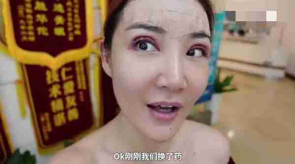 央视女主播自曝整容?晒割双眼皮手术全过程,做完连夸自己变年轻
