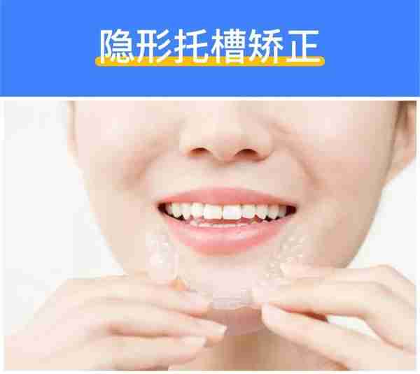 深度揭秘:牙齿矫正到底需要多少钱?