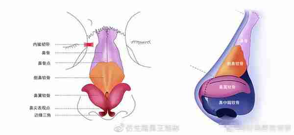 醒醒吧!L型假体隆鼻+耳软骨垫鼻尖,还在骗你是鼻综合