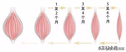 关于瘦脸针,你们想了解的都在这儿了