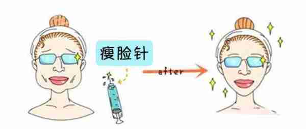 瘦脸针究竟会不会有副作用?需要注意哪些事情?
