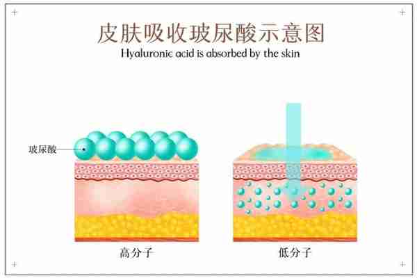 玻尿酸——天使还是魔鬼?