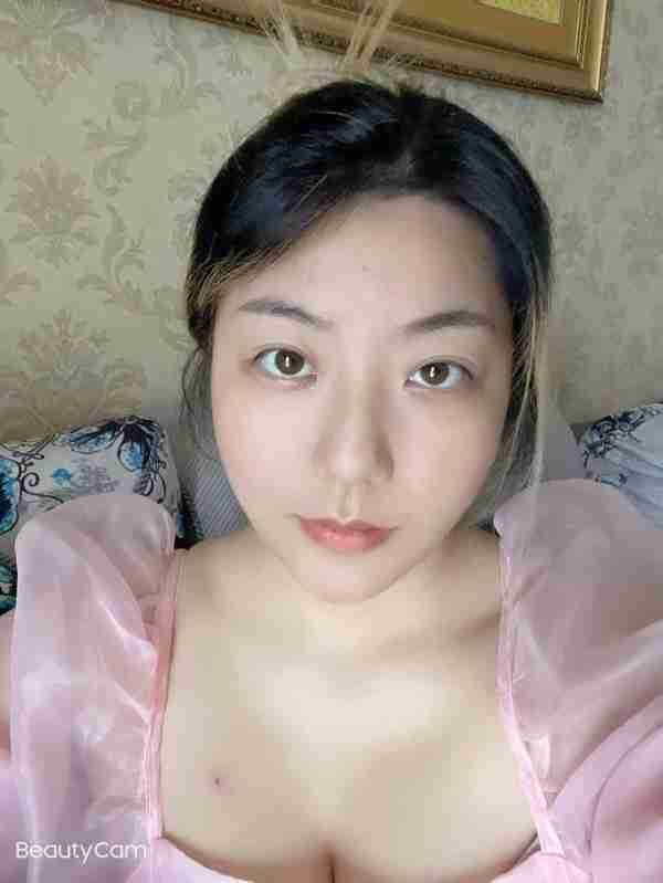 30岁小姐姐做完面部吸脂60天,朋友还以为我悄悄地换了一张脸