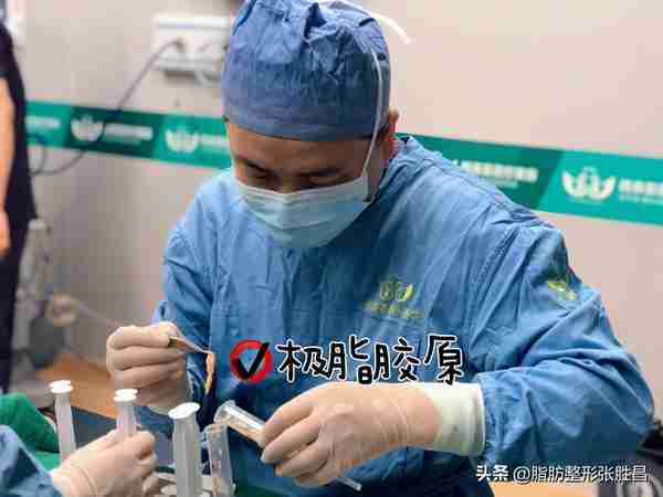 我来揭开“脂肪填充”的5个真相，想做这手术的人可以来看看