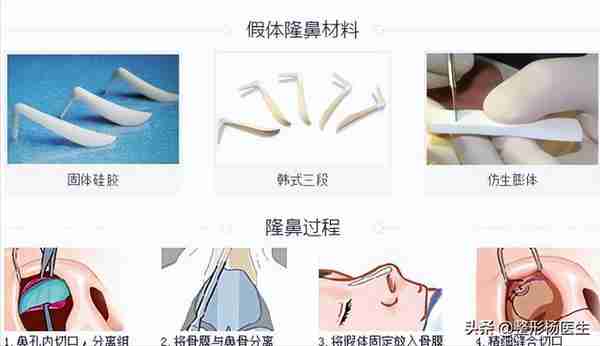 想要隆鼻!隆鼻手术种类形形色色,究竟怎么选?
