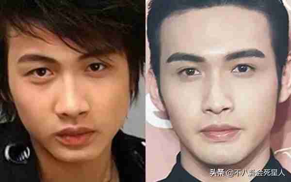 25位明星割过双眼皮,谁自然谁“毁容”一目了然