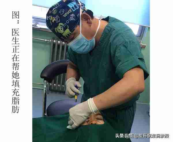 怎么做全脸脂肪填充不后悔?看了我的这一段经历就懂了