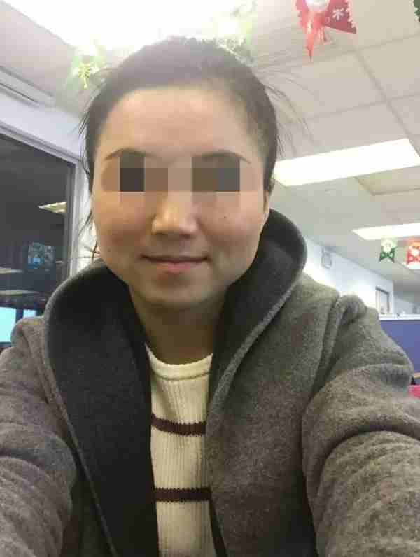 被瘦脸针“毁容”之后,索赔200万仅可得1万 法律保护健康但不保护美