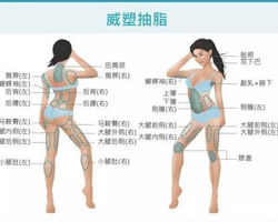 吸脂该如何选择?威塑吸脂有什么危害吗