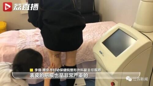 花6万元吸脂后皮肤坏死,双腿凹凸不平!还没修复好,整形医院去哪了?
