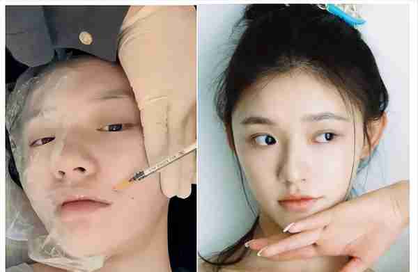 医美水光针、羊胎素盛行,一针58万却供不应求,明星渴望青春永驻
