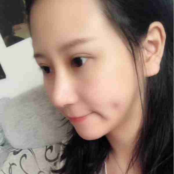 来谈谈我做伊婉V玻尿酸隆鼻的经历