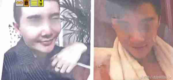 46800元的瘦脸针变胖脸针，这让女子如何接受