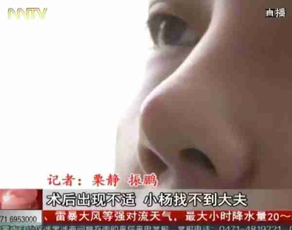 「天天看•热线」术后特别疼!19岁学生花7千多隆鼻,医生竟然说后果很严重