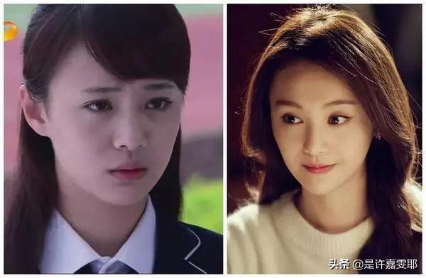关于瘦脸针,你们想了解的都在这儿了