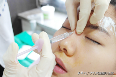 面部一枝花,全靠鼻当家,“一支玻尿酸”解救娱乐圈无数塌鼻梁