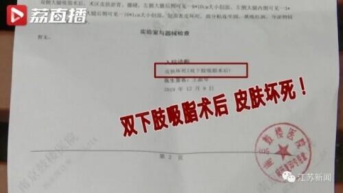 花6万元吸脂后皮肤坏死,双腿凹凸不平!还没修复好,整形医院去哪了?