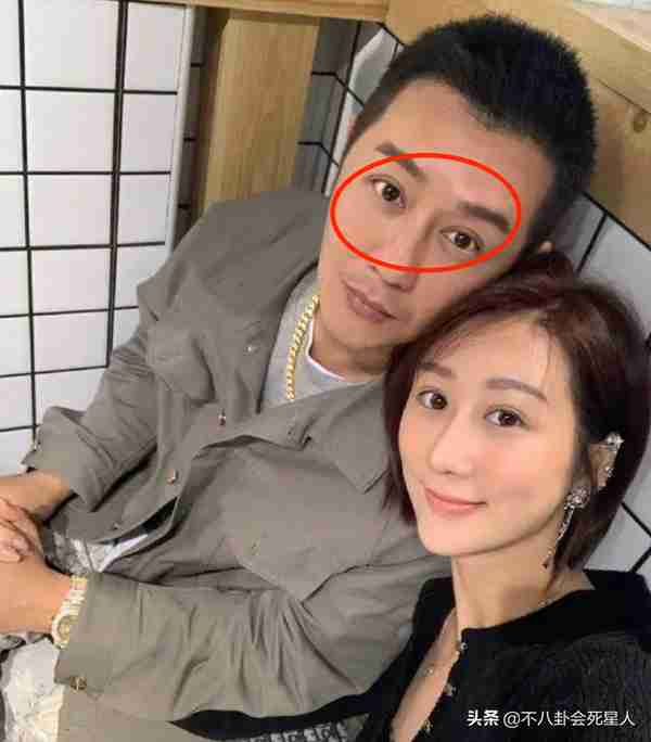 25位明星割过双眼皮,谁自然谁“毁容”一目了然