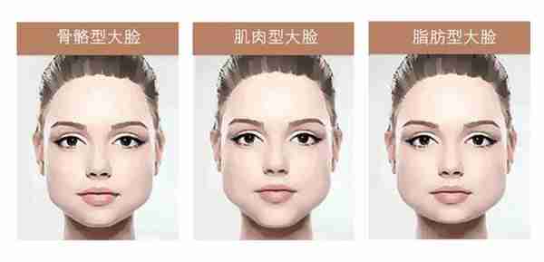 不想手术追求小脸美颜,面部吸脂和瘦脸针如何选择?