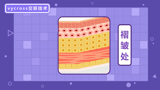 好的玻尿酸拥有哪些特质?种类繁多,玻尿酸该怎么选?