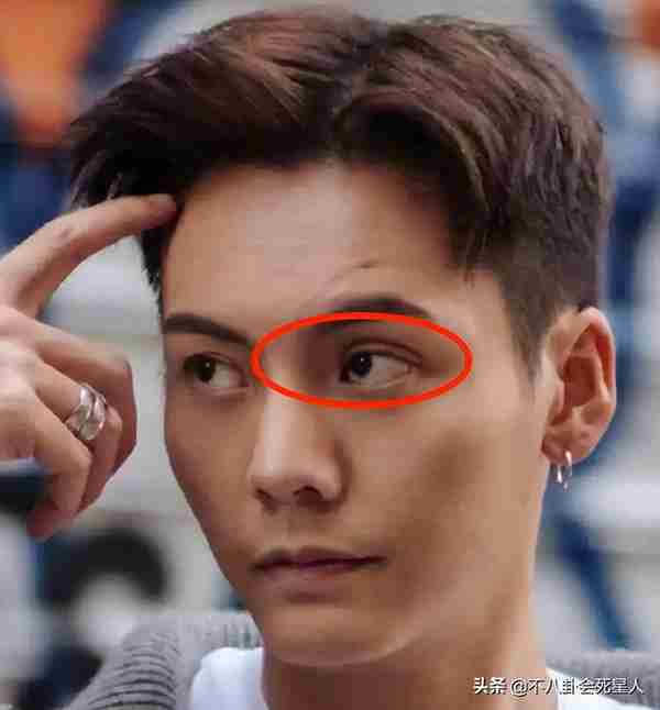 25位明星割过双眼皮,谁自然谁“毁容”一目了然