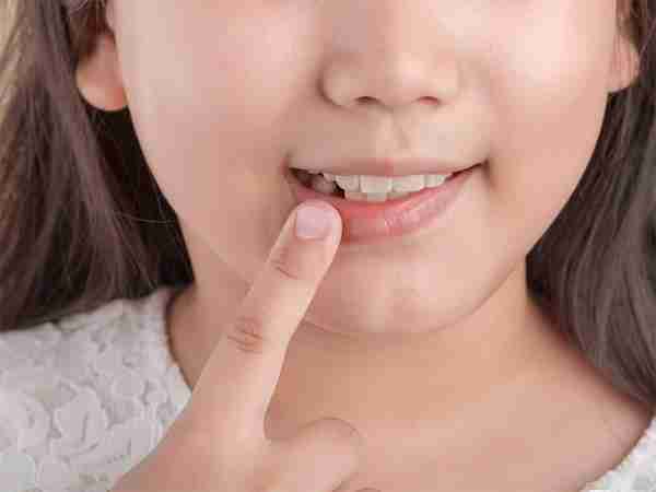 小孩牙齿长歪了怎么办?