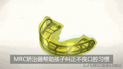 儿童地包天怎么办?