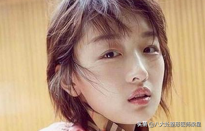 拥有迷人的双眼皮是美女们的标配,埋线双眼皮你一定要了解一下