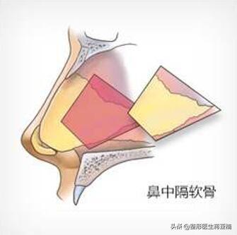辟谣辟谣 | 耳软骨隆鼻不能做,是真的吗