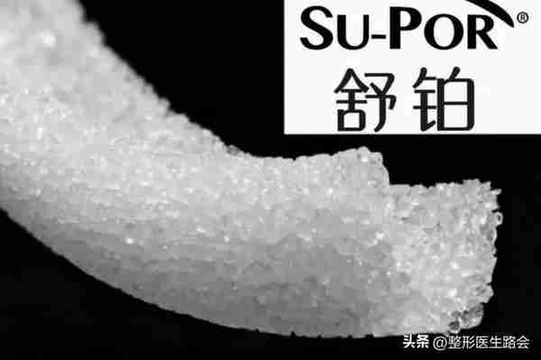 超体?超肋?舒铂?人工骨?曼特波?异体骨?肋骨?该如何选择?