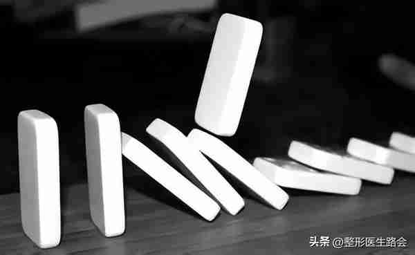 超体?超肋?舒铂?人工骨?曼特波?异体骨?肋骨?该如何选择?