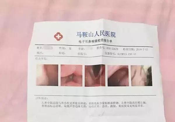 安徽女子花2万多隆鼻,总能闻到臭味!竟从鼻腔里取出一长条纱布