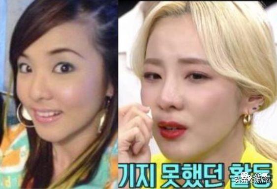 那个十年整了4次变成木偶人的女爱豆,请看看你的队友吧