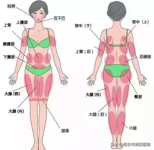 吸脂瘦身!减肥路上的弯道超车选手,下个时节C位归你!