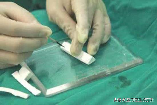 医生不会说的 | 膨体隆鼻,老了以后会怎样?