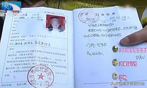 整容变毁容!女孩脸颊注射玻尿酸,近看面部凹凸不平一言难尽