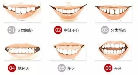 牙齿不整齐怎么办?预约这个直播,口腔医生给你专业答案!