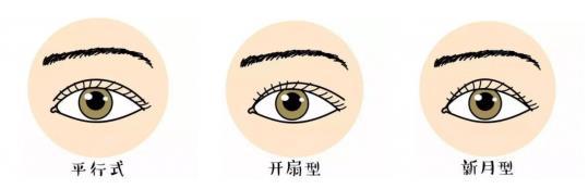 想做双眼皮手术?有些不是永久性的哦
