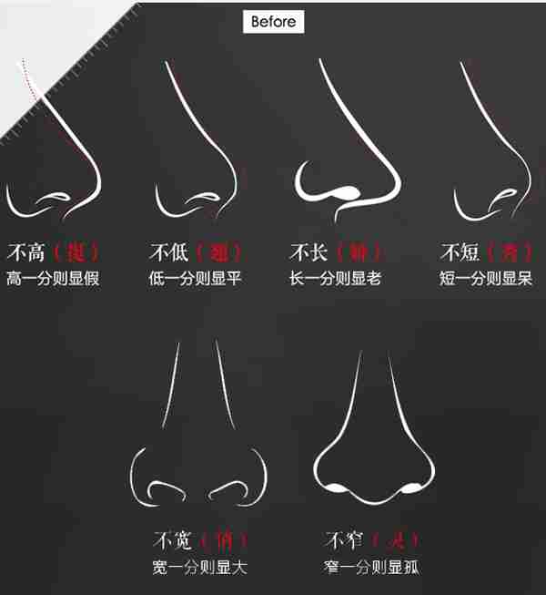欧式挺隆鼻