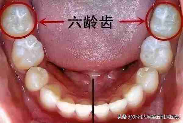 儿童换牙学问大,这些知识点请各位家长牢记