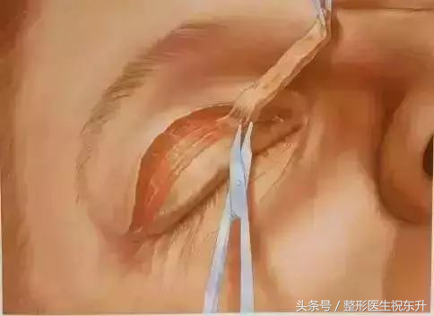 想做全切双眼皮,又担心不安全,有没有人可以给点真实性的建议?