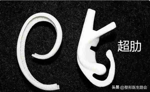 超体?超肋?舒铂?人工骨?曼特波?异体骨?肋骨?该如何选择?
