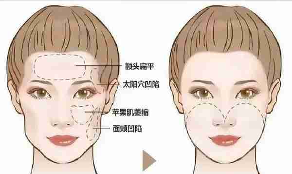 爆火的“轮廓固定”,如何花最少的钱达到最大效果,秒变“女神”