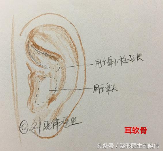 鼻整形科普：什么才是鼻综合手术？包含什么项目？