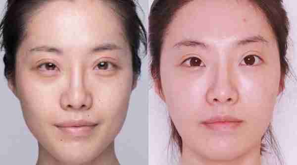 干货!最全的护肤品“成分”解析,搞懂了皮肤想不好都难