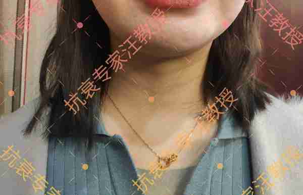 听说你想用玻尿酸填充?醒醒吧姑娘!汪教授愤怒揭秘这5个真相